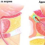 Pain in the lower abdomen in men: localization, causes, symptoms. Diagnosis and treatment options 