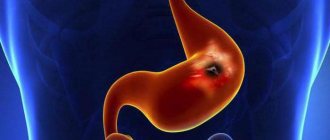 What are the pains with gastritis?