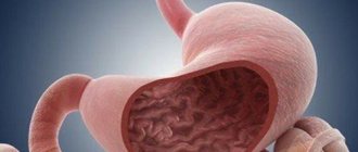 Hypertrophic gastritis is characterized by thickening of the stomach lining, a decrease in the number of gastric folds and an increase in their thickness