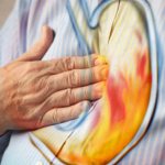 Как понизить кислотность желудка - признаки и как лечить