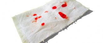 Blood on toilet paper