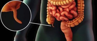 Main signs of appendicitis in men
