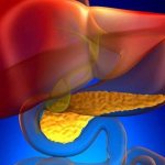 Destructive pancreatitis: causes, symptoms, diagnosis and treatment