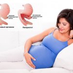 Pancreatitis during pregnancy
