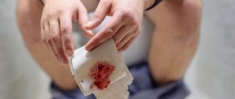 Why does blood appear in stool?