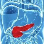 Causes of pancreatic enlargement, clinical picture and diagnosis