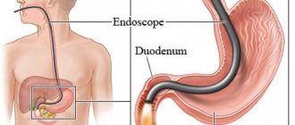 путь эндоскопа в желудок