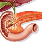 Reactive changes in the pancreas in a child