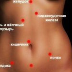 Symptoms of appendicitis in women, how to determine at home
