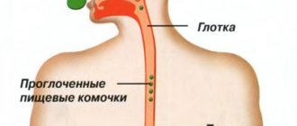 Spasm of the esophagus (esophagospasm): causes, symptoms and treatment, how to relieve an attack at home