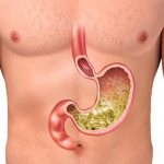 TOP 6 drugs for the treatment of high stomach acidity